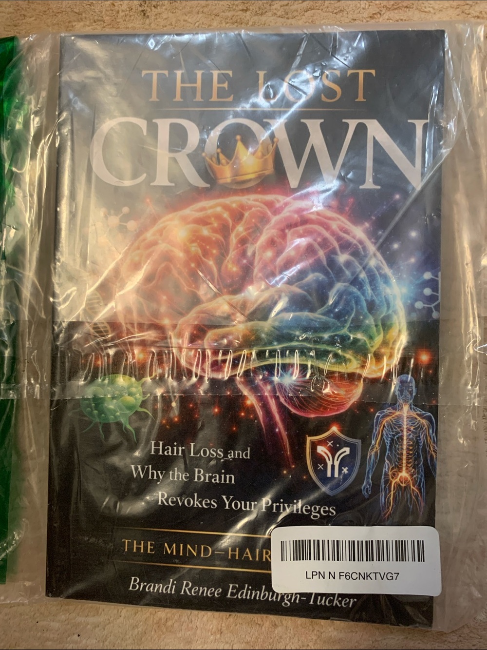 The Lost Crown: Hair Loss and Why the Brain Revokes Your Privileges Paperback